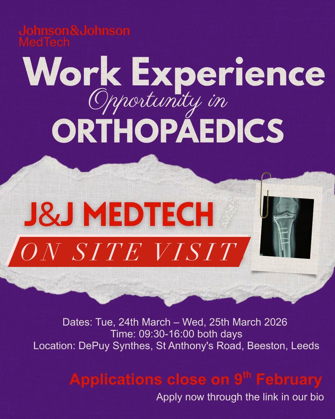 The image for the event named Johnson & Johnson MedTech Work Experience